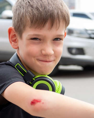 Selective focus Boy with a fresh wound on his arm, blood on his elbow. The man injured his arm during the fall and is trying to smile. Copy space, selective focusの写真素材