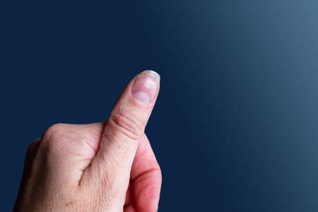 Close-up of an injured finger with an open cut on a blue background, copy space. Household trauma...