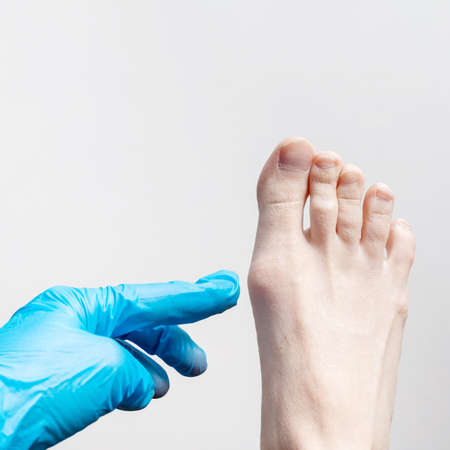 Hand in a blue medical glove, an orthopedic surgeon examines a womans leg, foot screening test