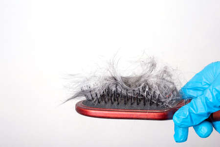 Hair loss problem. Gray, dark hair, wool on a comb on a light background, copy space. Human alopecia...
