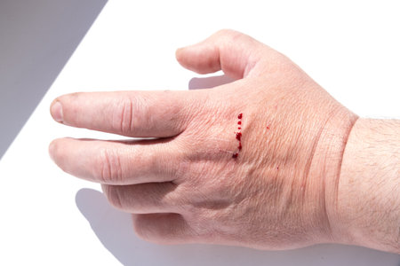 A wound on a mans hand with red drops of blood. The cat scratched the owners hand.の写真素材