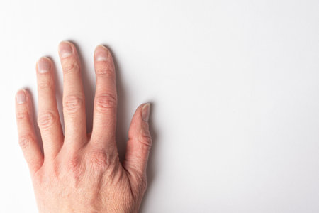 Close-up of a woman's age-old hand with wrinkles with natural nails, overgrown cuticle on a white background, top view, copy space. A hand with age related changes. The concept of natural nailsの写真素材