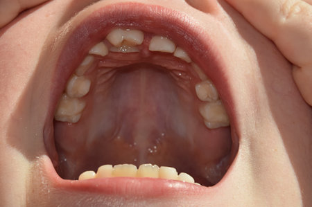 baby teeth of a child, an open mouth of a girl. background for the design. dentistry