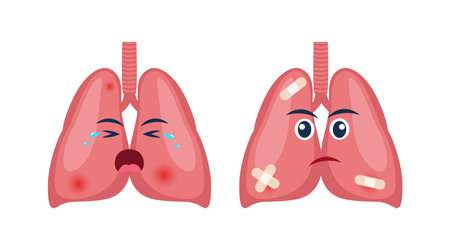 Sick lungs with pain ache or disease. Sad cartoon character lungs, body organ injured or unhealthy. Human cartoon anatomy, kids medicine. vector illustrationのイラスト素材