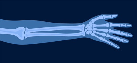 X ray human hand. Body bone roentgen front view. Medical anatomy. Arm checking healthcare joint palm finger exam. Radiology scan MRI hospital traumatology. Vectorのイラスト素材