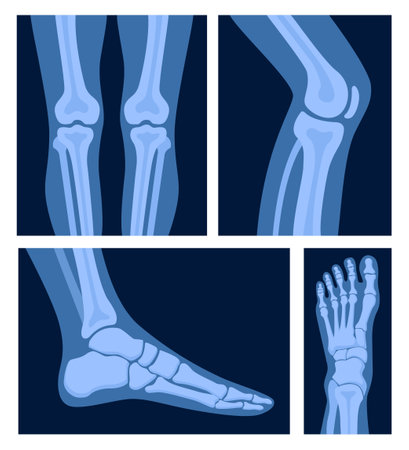 Different x-rays shot of human body part, set. Various x-ray pictures of foot, leg. Vector illustrationのイラスト素材
