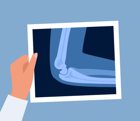 Xray scan of elbow joint. Anatomical structure, care and diagnosis for pain in the arm. Roentgen shot in doctors hand. Vector illustrationのイラスト素材