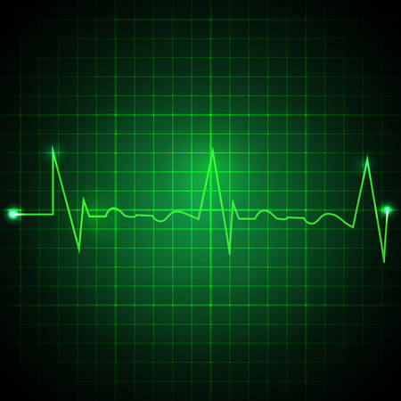 Heart pulse graphic. Ekg line on green background. Cardiogram background. Vector illustrationのイラスト素材
