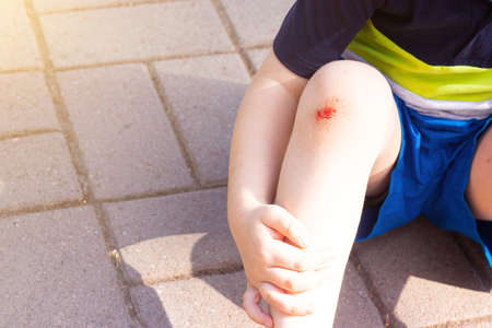 The wound on the child's leg. Fell on the road. Broken knee. Health. Article about the fall of a child. Article about the treatment of wounds. Bad leg. The child fell and broke his knee. bloodの写真素材