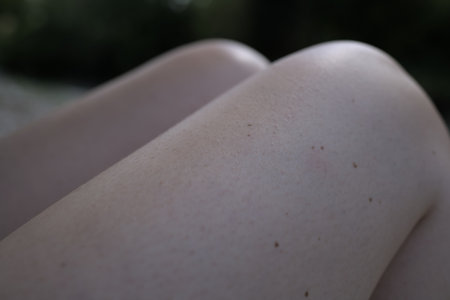 Black spots on the skin in the legs