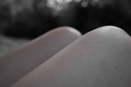 Black spots on the skin in the legs of womanの写真素材