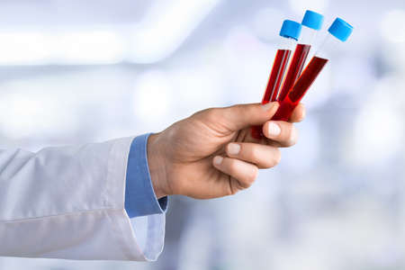 Doctor with medical tube on hospital backgroundの写真素材