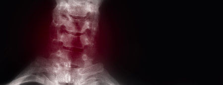 x-ray neck painful, medical concept, panoramic mock-upの写真素材