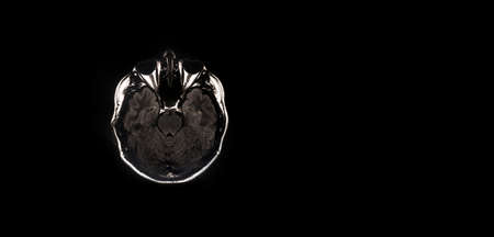 Magnetic resonance image (MRI) of normal brain, panoramic mock-upの写真素材