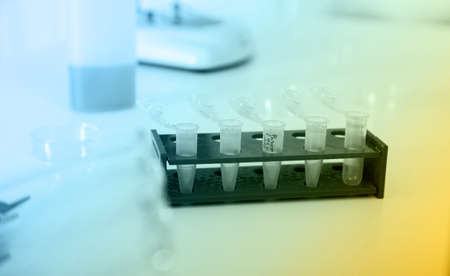 Micro tubes with biological samples in laboratory for DNA analysis