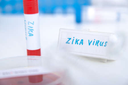 Blood sample positive with Zika virus.toned image.の写真素材