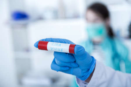 Blood sample positive with Zika virus.toned imageの写真素材