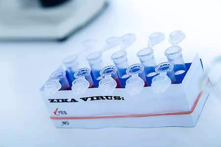 Micro tubes with  Blood sample positive with Zika virusの写真素材