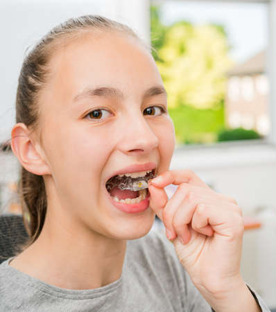 Teenager with braces on her teeth.