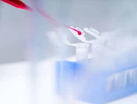 Medical equipment. Blood test.Pipette adding fluid to one of several test tubesの写真素材