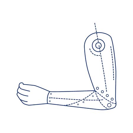 Bio artificial hand black line icon. Type of prosthesis. Replaces an absent natural hand. Pictogram for web page, mobile app, promo. UI UX GUI design element. Editable strokeのイラスト素材
