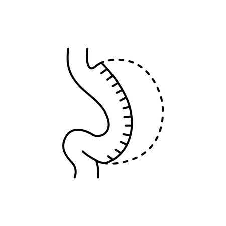Sleeve gastrectomy olor line icon. Pictogram for web page, mobile app, promo. UI UX GUI design element. Editable stroke.のイラスト素材