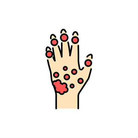 Psoriatic Arthritis color line icon. Pictogram for web page, mobile app, promo.のイラスト素材