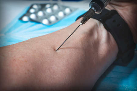 The injection of a drug into the patient's arm with a syringe. Needle for injection close-upの写真素材