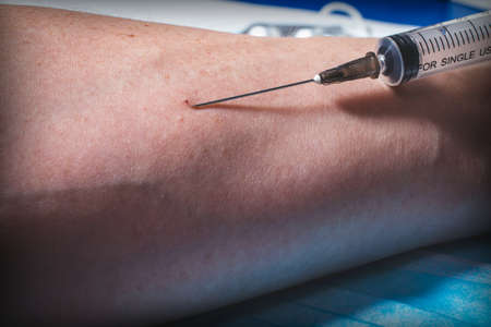 The injection of a drug into the patient's arm with a syringe. Needle for injection close-upの写真素材