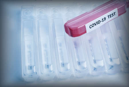 Test tube labeled COVID-19 with a blood test on a background of clean medical tubes. The problem of the spread of coronavirus infectionの写真素材