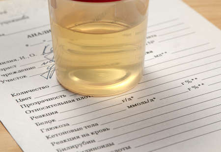 Medical examination of urine in a plastic glassの写真素材