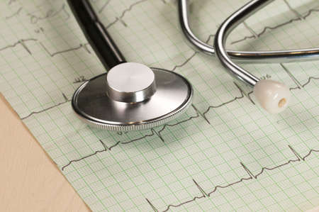 Stethoscope on electrocardiogram paper, closeup shot, local focus