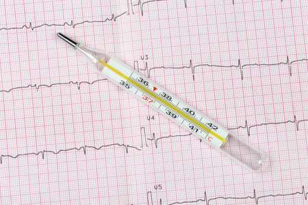 Mercury-in-glass thermometer on electrocardiogram close-up
