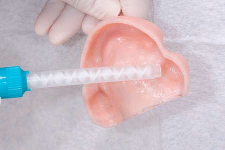 oral rehabilitation process, partial removable prosthesis