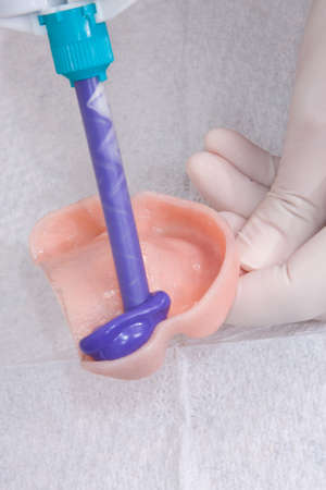 oral rehabilitation process, partial removable prosthesis
