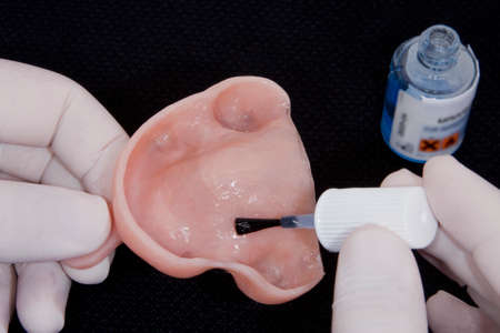 oral rehabilitation process, partial removable prosthesis