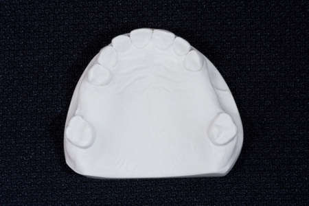 oral rehabilitation process, partial removable prosthesis