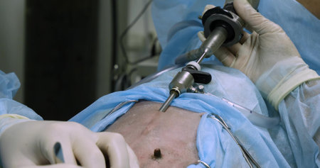 The veterinary assistant holds the laparoscopic instrument while the surgeon makes an incision in the abdomen of the animal. Laparoscopic sterilization of dogs of large breeds.の写真素材