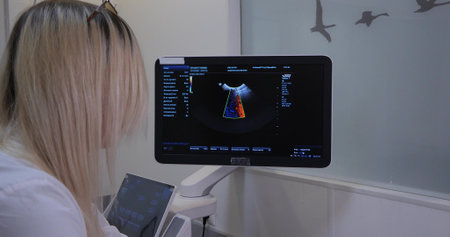 A blonde veterinarian performs an ultrasound scan on a pet using Doppler. Close-up, view from behind. Woman doctor examines the results of the study. Pet ultrasound concept.の写真素材