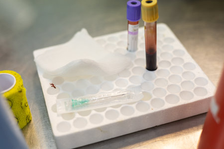 Test tubes with blood for analysis are in a stand in the laboratory. Blood in test tubes is on the...