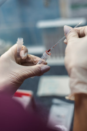The close plan of the laboratory assistant in gloves performing a blood test, moving a sample into a...