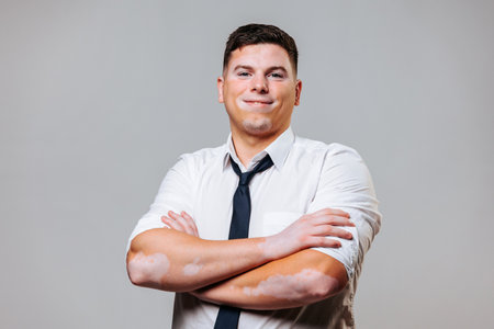 Crossing his arms over his chest, a young man with symmetrical spots on his face and arms looks into the camera. People with skin diseases must be informed about them. Studio shot gray backgroundの写真素材