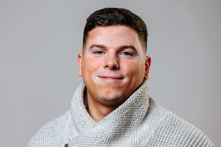 Male with vitiligo highlights skin condition at awareness eventの写真素材