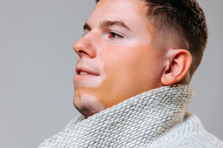 Man with vitiligo showcasing confidence wearing a cozy scarf indoors