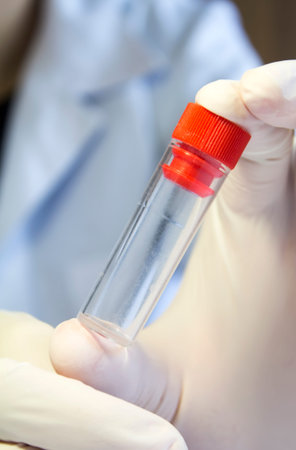 Hands in medical gloves holding empty plastic tube with red cap.