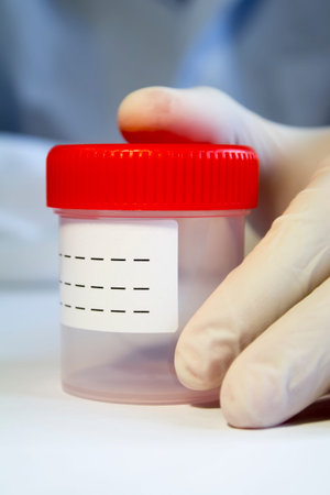 Hands in medical gloves holding empty plastic container with red cap for collecting material for...