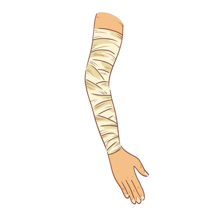 Bandaged hand in flat design. Injured human arm with bandage compression. Vector illustration isolated.のイラスト素材