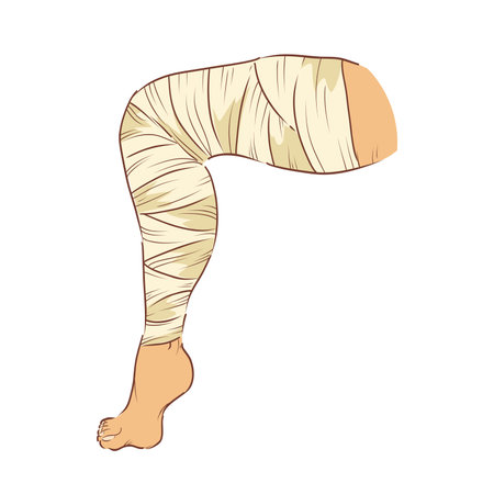 Bandaged leg in flat design. Injured patient body part with bandage apply. Vector illustration isolated.のイラスト素材