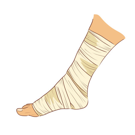 Bandaged ankle in flat design. Hospital aid for injured foot with bandage. Vector illustration isolated.のイラスト素材