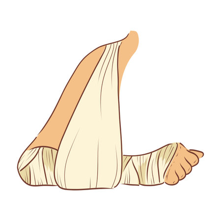 Bandaged hand with support in flat design. Broken arm and wrist in gypsum. Vector illustration isolated.のイラスト素材